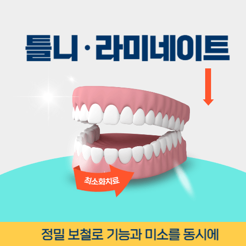 안동치과 안동시 치과 틀니 라미네이트