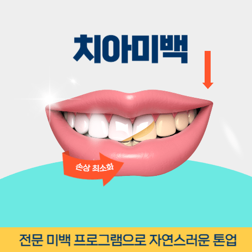 안동치과 안동시 치과 치아미백
